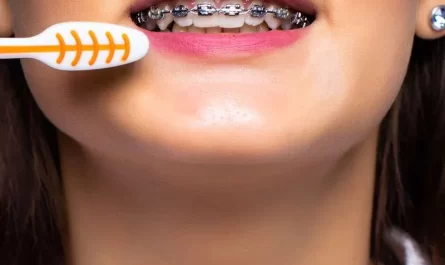 use a electric toothbrush with braces